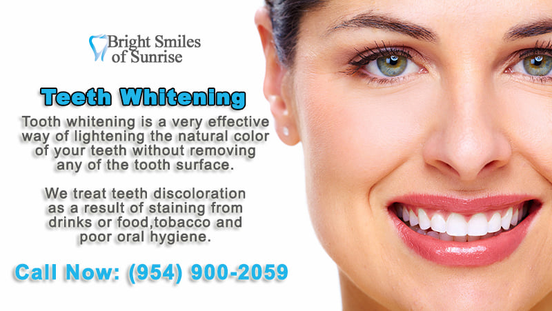 Teeth Whitening – Dentist Oakland Park, FL