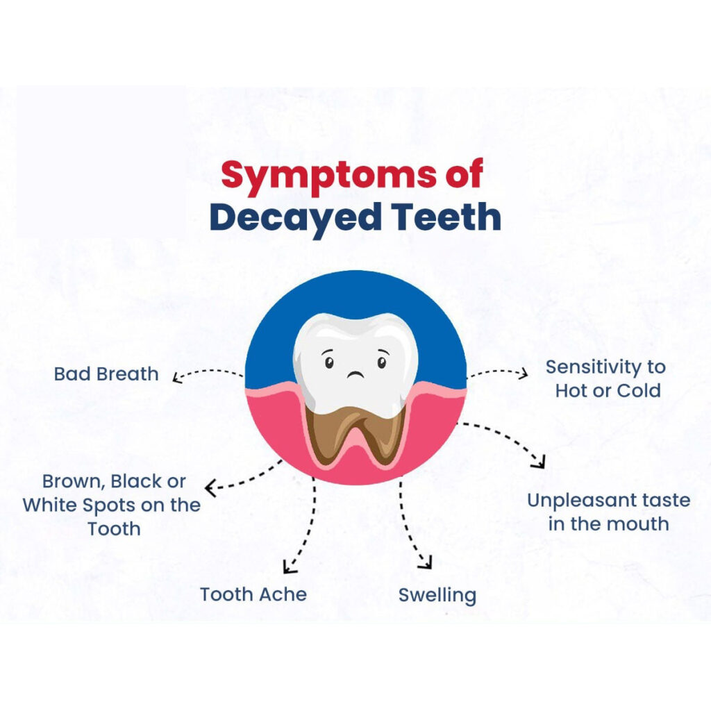 Symptoms Of Decayed Teeth Dentist Oakland Park Fl